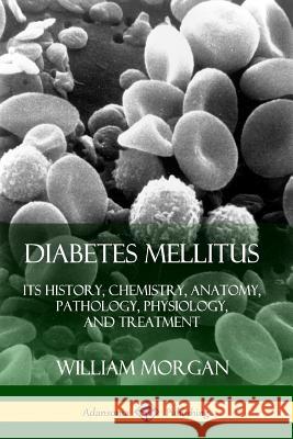 Diabetes Mellitus: Its History, Chemistry, Anatomy, Pathology, Physiology, and Treatment William Morgan 9780359732913