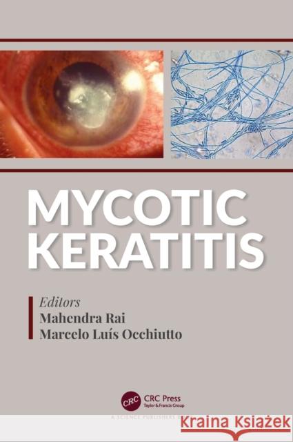 Mycotic Keratitis Mahendra Rai   9780367075934 CRC Press