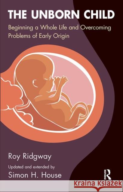 The Unborn Child: Beginning a Whole Life and Overcoming Problems of Early Origin Ridgway, Roy 9780367105648 Taylor and Francis