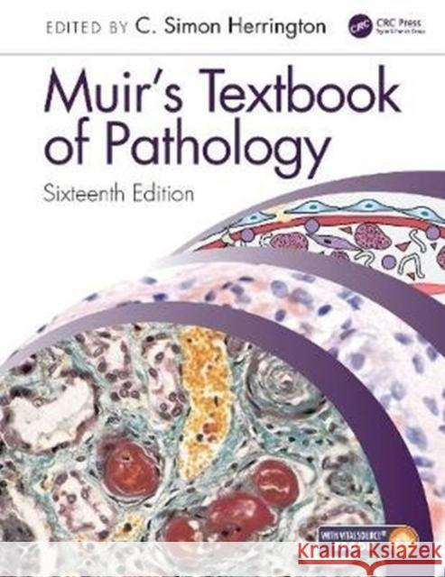 Muir's Textbook of Pathology: Sixteenth Edition International Student Edition Herrington, C. Simon 9780367146726 CRC Press