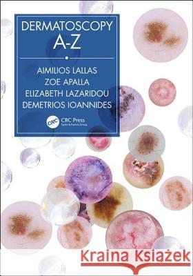 Dermatoscopy A-Z Aimilios Lallas Zoe Apalla Elizabeth Lazaridou 9780367197810 