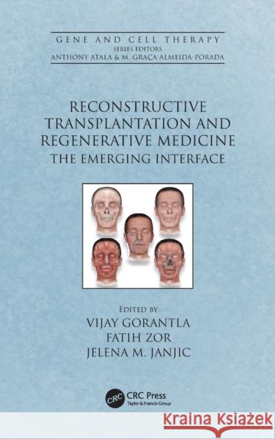 Reconstructive Transplantation and Regenerative Medicine: The Emerging Interface Vijay Gorantla Faith Zor Jelena M. Janjic 9780367202088 CRC Press