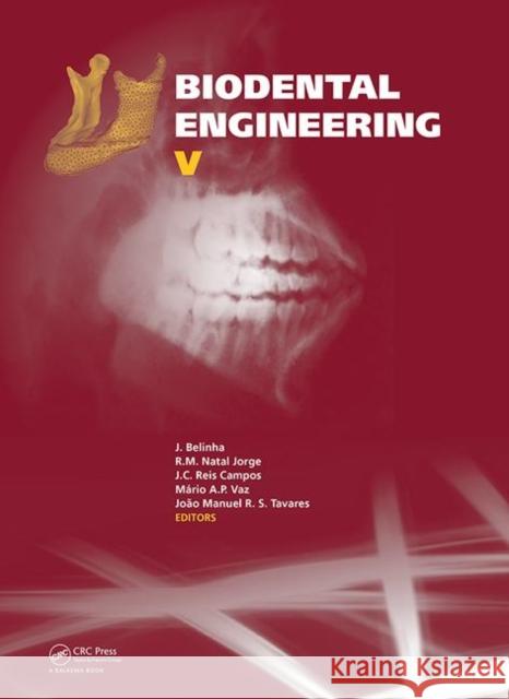 Biodental Engineering V: Proceedings of the 5th International Conference on Biodental Engineering (Biodental 2018), June 22-23, 2018, Porto, Po Jorge Belinha R. M. Natal Jorge J. C. Rei 9780367210878 CRC Press