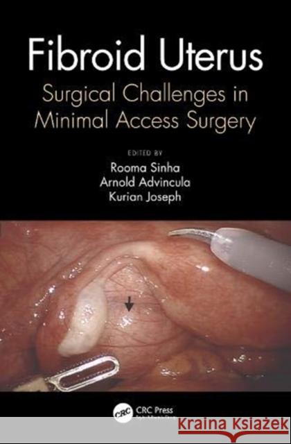 Fibroid Uterus: Surgical Challenges in Minimal Access Surgery Rooma Sinha Arnold Advincula Kurian Joseph 9780367247324 CRC Press