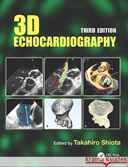 3D Echocardiography Takahiro Shiota 9780367252885 CRC Press