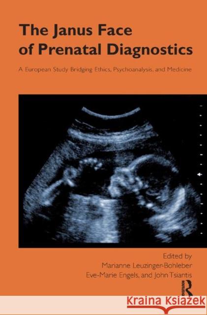 The Janus Face of Prenatal Diagnostics: A European Study Bridging Ethics, Psychoanalysis, and Medicine Leuzinger-Bohleber, Marianne 9780367328092
