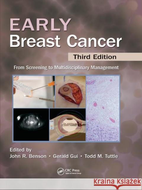 Early Breast Cancer: From Screening to Multidisciplinary Management, Third Edition Benson, John R. 9780367380465 Taylor and Francis