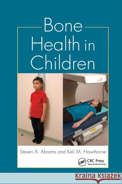 Bone Health in Children Steven A. Abrams Keli M. Hawthorne 9780367381622 CRC Press