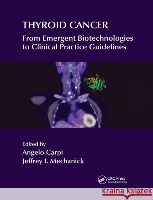 Thyroid Cancer: From Emergent Biotechnologies to Clinical Practice Guidelines Angelo Carpi Jeffrey I. Mechanick 9780367382711 CRC Press