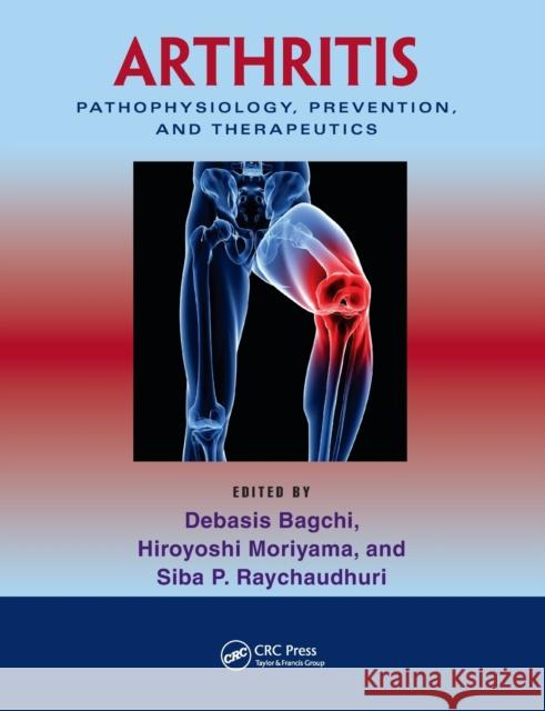 Arthritis: Pathophysiology, Prevention, and Therapeutics Debasis Bagchi Hiroyoshi Moriyama Siba P. Raychaudhuri 9780367382872 CRC Press