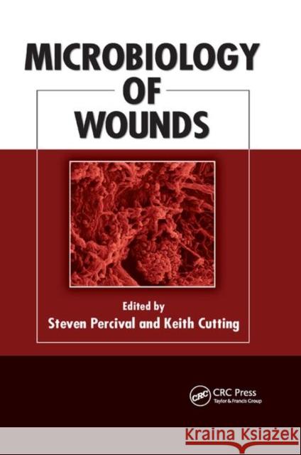 Microbiology of Wounds Steven Percival (Advanced Medical Soluti Keith Cutting (Buckinghamshire New Unive  9780367384203 CRC Press