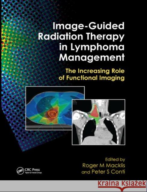 Image-Guided Radiation Therapy in Lymphoma Management: The Increasing Role of Functional Imaging Roger M. Macklis Peter S. Conti 9780367384487 CRC Press