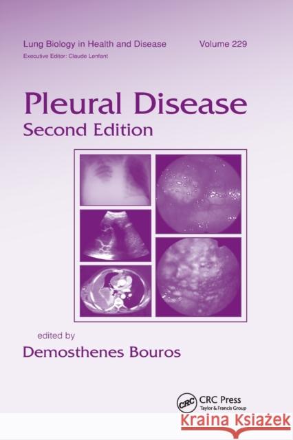 Pleural Disease Demosthenes Bouros 9780367384562 CRC Press