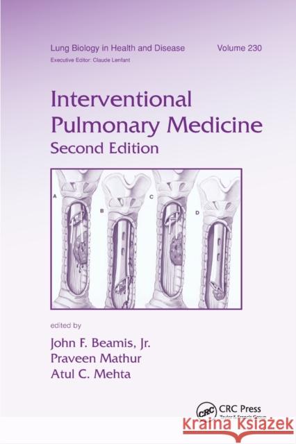 Interventional Pulmonary Medicine John F. Beamis Praveen Mathur Atul C. Mehta 9780367384821 CRC Press