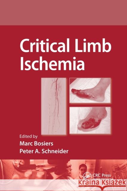 Critical Limb Ischemia Marc Bosiers Peter Schneider 9780367385514 CRC Press