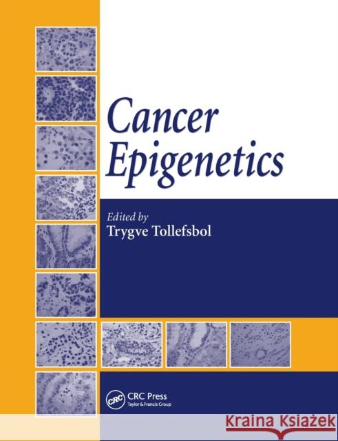 Cancer Epigenetics Trygve Tollefsbol 9780367386863 CRC Press