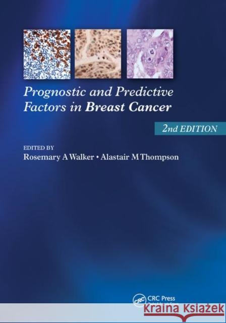 Prognostic and Predictive Factors in Breast Cancer Rosemary A. Walker Alistair M. Thompson 9780367386931 CRC Press