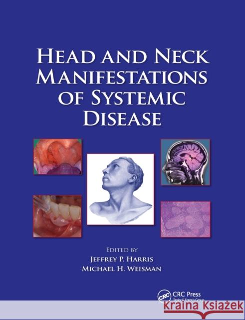 Head and Neck Manifestations of Systemic Disease Jeffrey P. Harris Michael H. Weisman 9780367388805 CRC Press