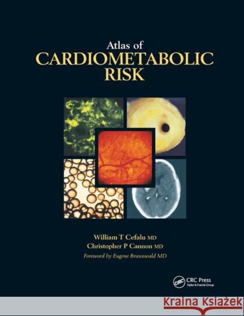 Atlas of Cardiometabolic Risk William T. Cefalu Christopher P. Cannon 9780367389246