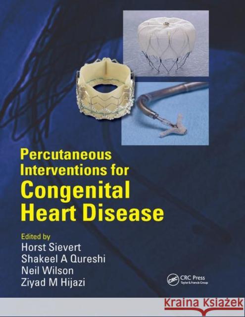 Percutaneous Interventions for Congenital Heart Disease Horst Sievert Shakeel Qureshi Neil Wilson 9780367389369