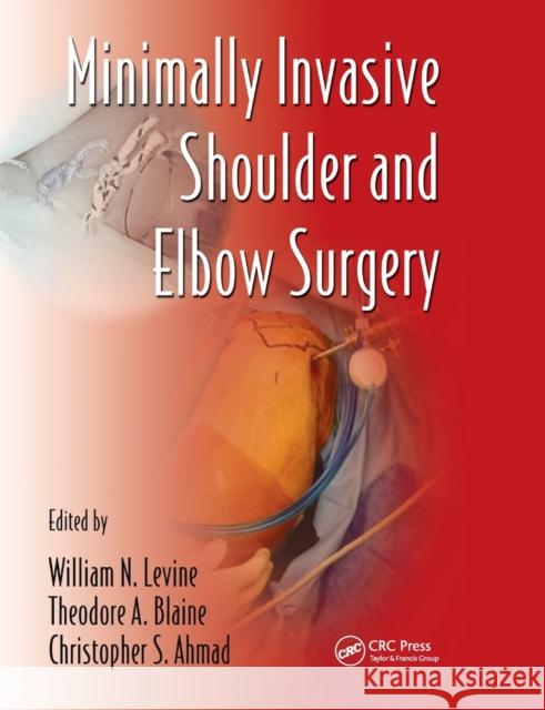 Minimally Invasive Shoulder and Elbow Surgery William N. Levine Theodore A. Blaine Christopher S. Ahmad 9780367389482