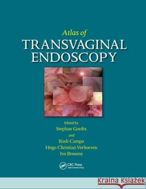 Atlas of Transvaginal Endoscopy Stephan Gordts Hugo C. Verhoeven Rudi Campo 9780367389543 CRC Press