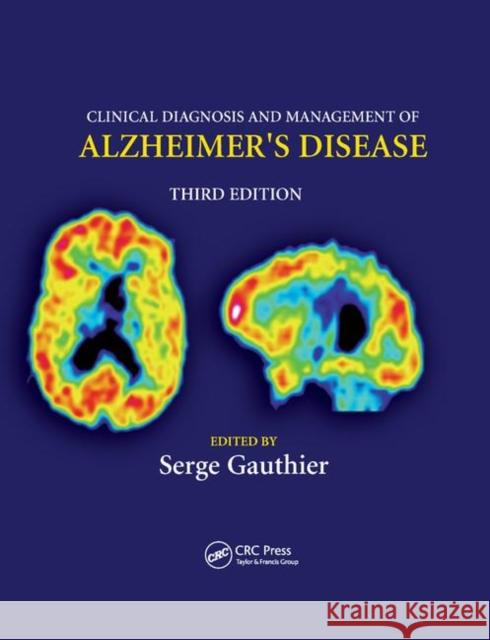 Clinical Diagnosis and Management of Alzheimer's Disease Serge Gauthier 9780367389833