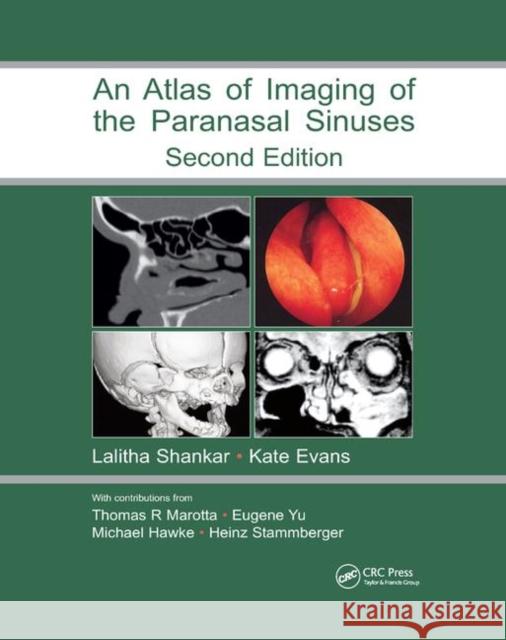 An Atlas of Imaging of the Paranasal Sinuses Lalitha Shankar Kathryn Evans 9780367390723