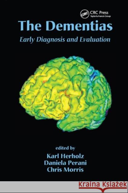 The Dementias: Early Diagnosis and Evaluation Karl Herholz Daniela Perani Chris Morris 9780367390730 CRC Press
