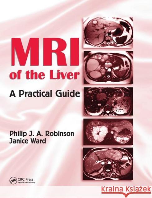 MRI of the Liver: A Practical Guide Philip J. a. Robinson Janice Ward 9780367390754 CRC Press