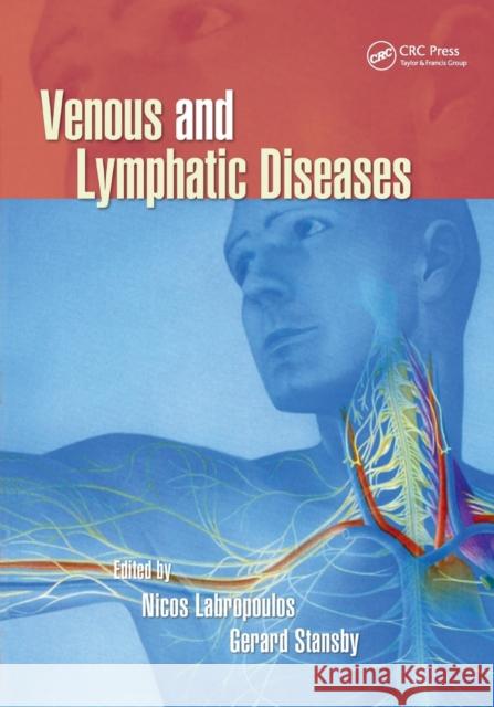 Venous and Lymphatic Diseases Nicos Labropoulos Gerard Stansby 9780367390853