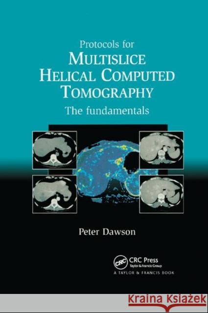 Protocols for Multislice Helical Computed Tomography: The Fundamentals Dawson Peter 9780367391201
