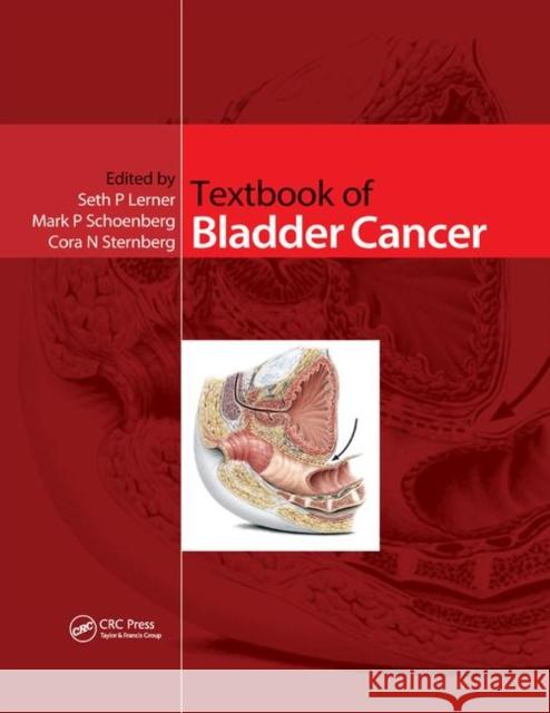 Textbook of Bladder Cancer Seth P. Lerner Mark Schoenberg Cora Sternberg 9780367391225 CRC Press