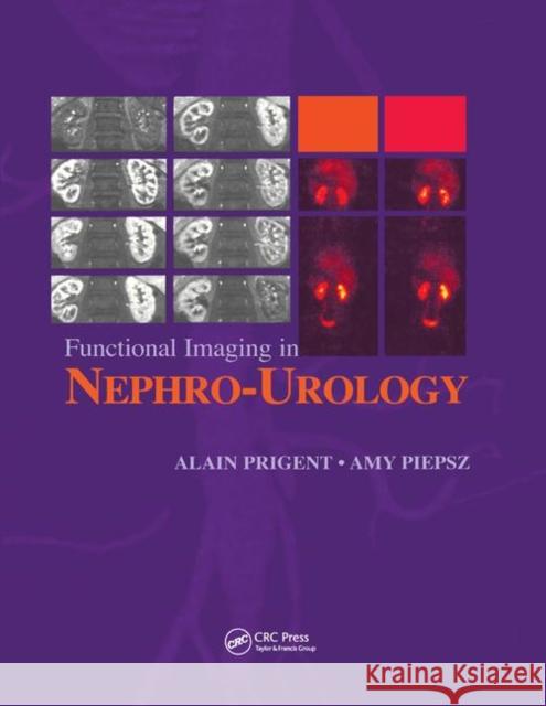 Functional Imaging in Nephro-Urology Alain Prigent Amy Piepsz 9780367391270 CRC Press