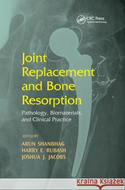 Joint Replacement and Bone Resorption: Pathology, Biomaterials and Clinical Practice Shanbhag, Arun 9780367391805