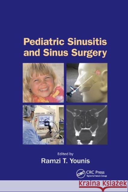 Pediatric Sinusitis and Sinus Surgery Ramzi T. Younis 9780367392055 CRC Press