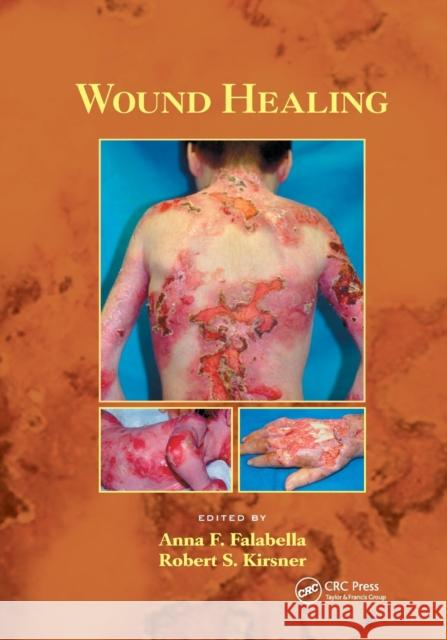 Wound Healing Anna Falabella Robert Kirsner 9780367392338 CRC Press