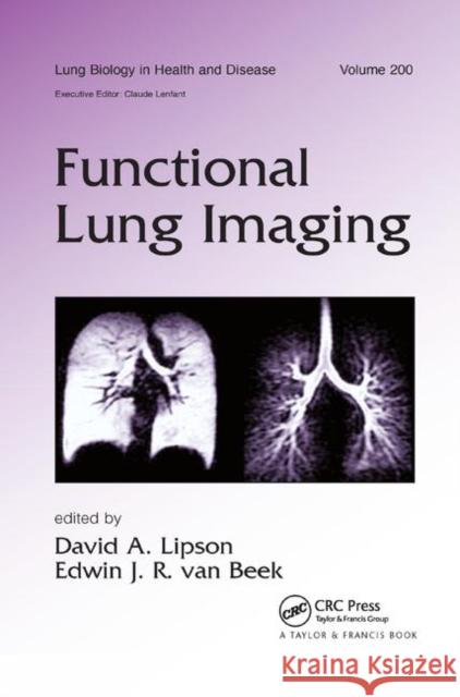 Functional Lung Imaging David Lipson Edwin Va 9780367392772 CRC Press