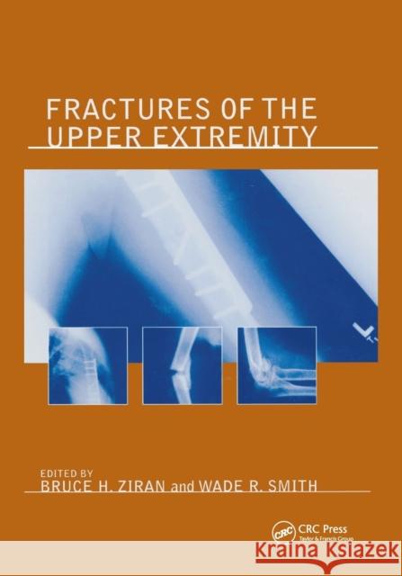 Fractures of the Upper Extremity Bruce H. Ziran 9780367394844