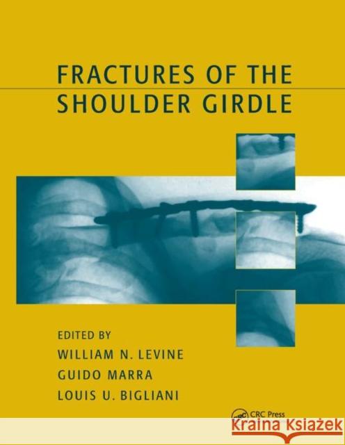 Fractures of the Shoulder Girdle William N. Levine Guido Marra 9780367395506 CRC Press