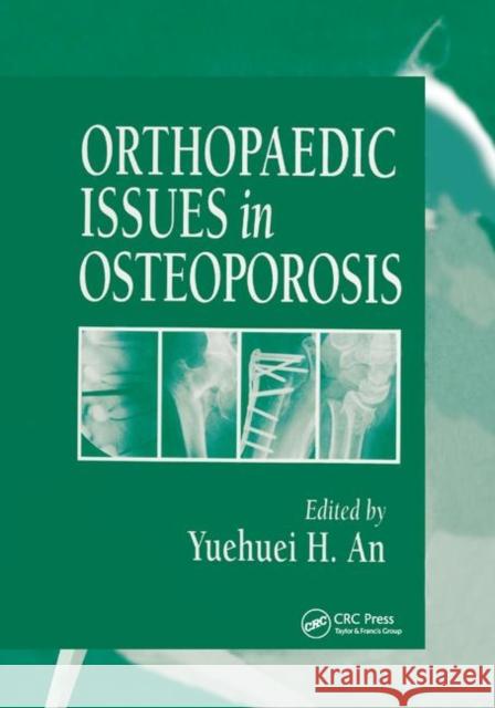 Orthopaedic Issues in Osteoporosis Yuehuei H. An 9780367395759 CRC Press