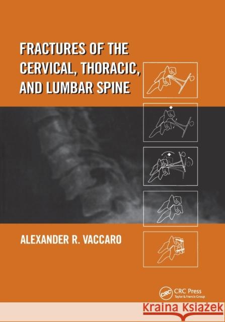 Fractures of the Cervical, Thoracic, and Lumbar Spine Alexander R. Vaccaro 9780367395797