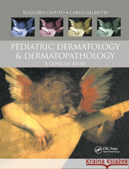 Pediatric Dermatology and Dermatopathology: A Concise Atlas Caputo, Ruggero 9780367396756 Taylor and Francis