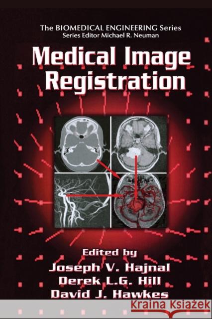 Medical Image Registration Joseph V. Hajnal Derek L. G. Hill 9780367397203 CRC Press