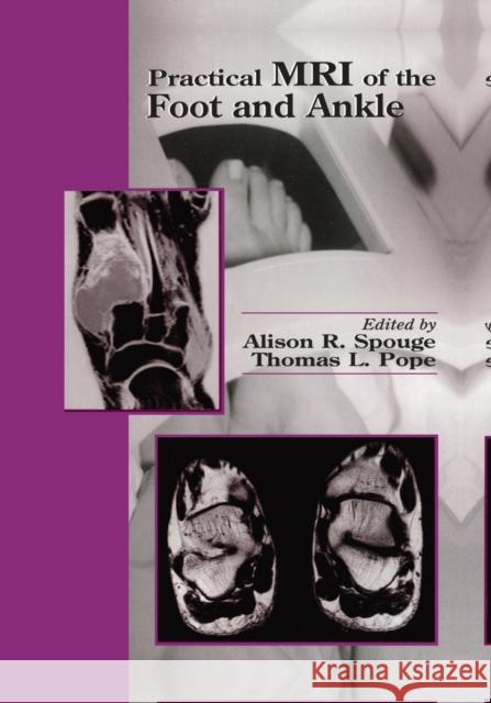 Practical MRI of the Foot and Ankle Alison R. Spouge Thomas L. Pope 9780367398156 CRC Press