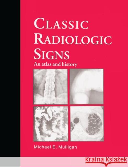 Classic Radiologic Signs: An Atlas and History M. E. Mulligan 9780367401153 CRC Press