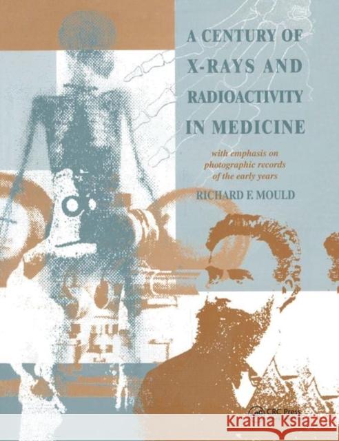 A Century of X-Rays and Radioactivity in Medicine: With Emphasis on Photographic Records of the Early Years R. F. Mould 9780367402518 CRC Press