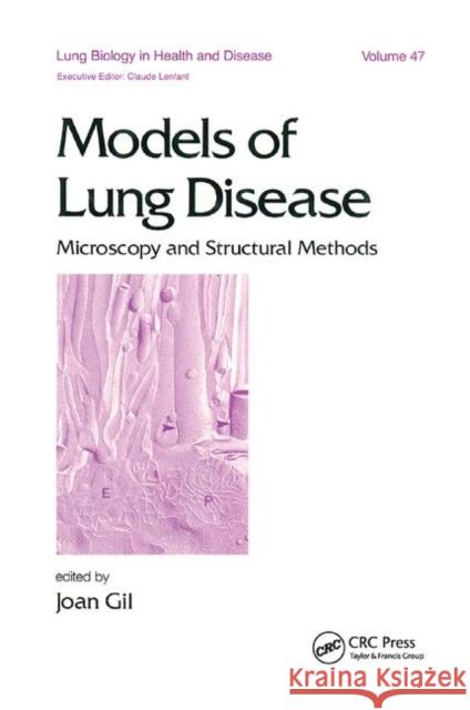 Models of Lung Disease: Microscopy and Structural Methods Gil, Joan 9780367403157 Taylor and Francis