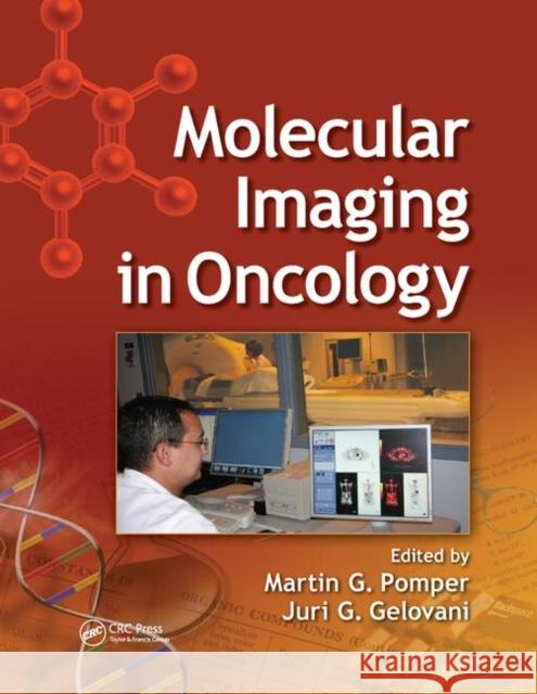 Molecular Imaging in Oncology Martin G. Pomper Juri G. Gelovani 9780367403485 CRC Press