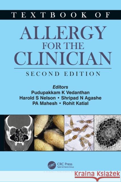 Textbook of Allergy for the Clinician Vedanthan, Pudupakkam K. 9780367405526 CRC Press